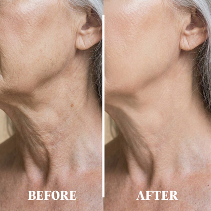 RevivaSkin Renewal Cream™
